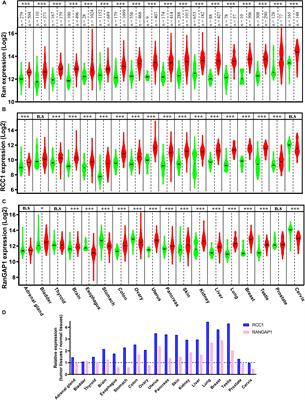 Ran GTPase: A Key Player in Tumor Progression and Metastasis